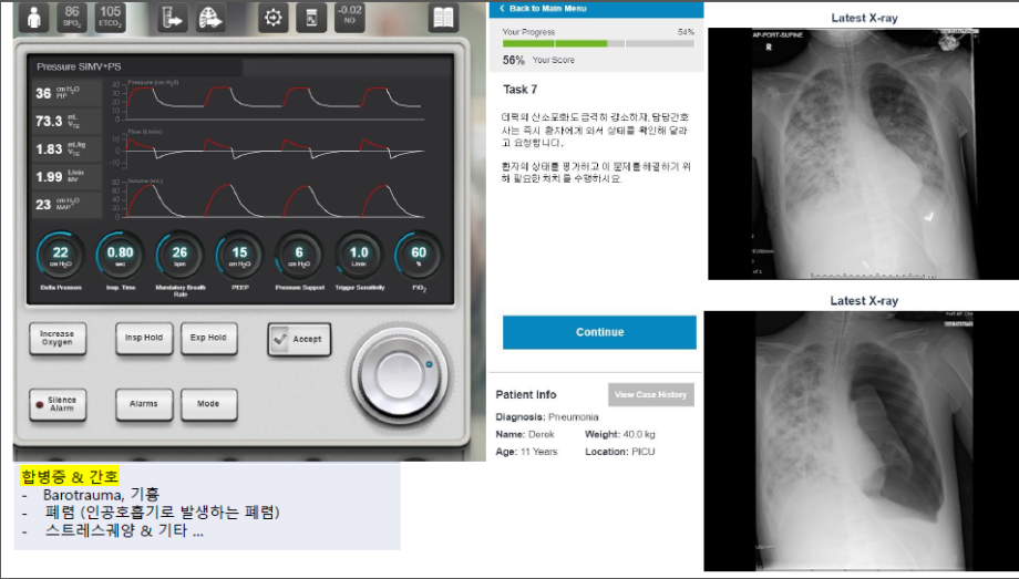 2020 간호사 국가고시 특강(성인간호학/ 호흡기계: Ventilator)