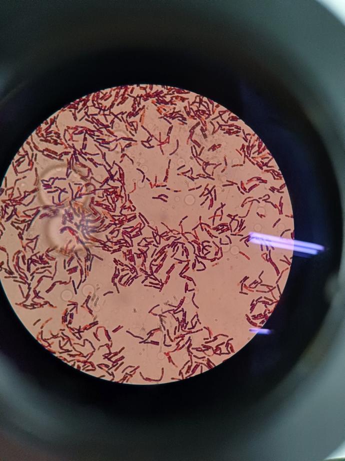 환경배양 해서 자란 균 동정(Oxidase, Catalase, Gram stain) 진행